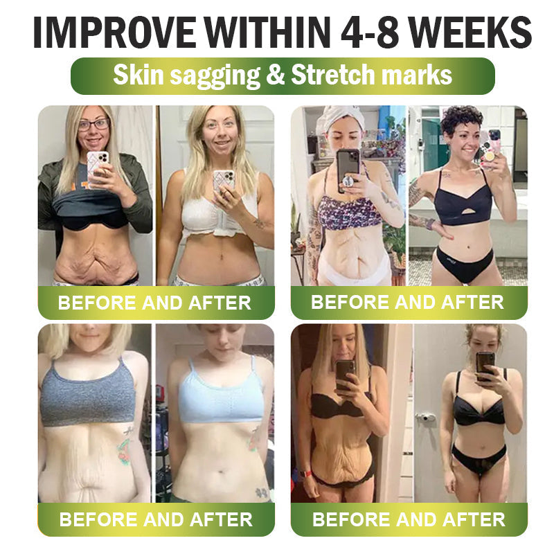 𝐂𝒓𝓪𝙯𝙮𝐋𝑒𝑎𝐟®丨 Only 5 boxes left! We're offering you an additional 30% discount! Get yourself in shape and healthy. Miss out now, and you won't have another chance until next year.