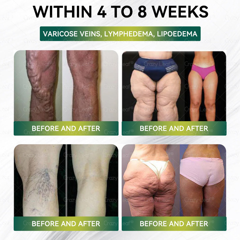 𝐂𝒓𝓪𝙯𝙮𝐋𝑒𝑎𝐟®丨 Only 5 boxes left! We're offering you an additional 30% discount! Get yourself in shape and healthy. Miss out now, and you won't have another chance until next year.
